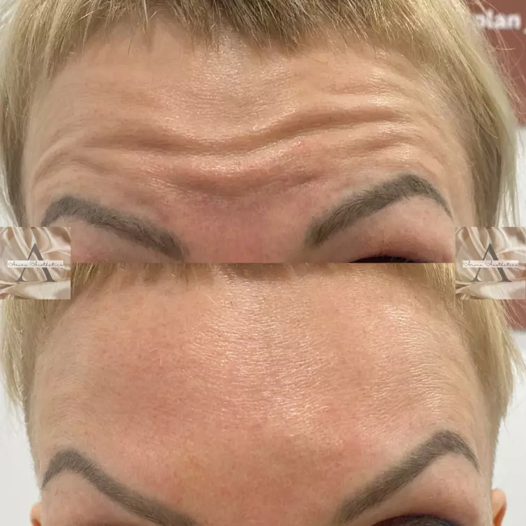 facial-aesthetics-neasden_1_ (1)