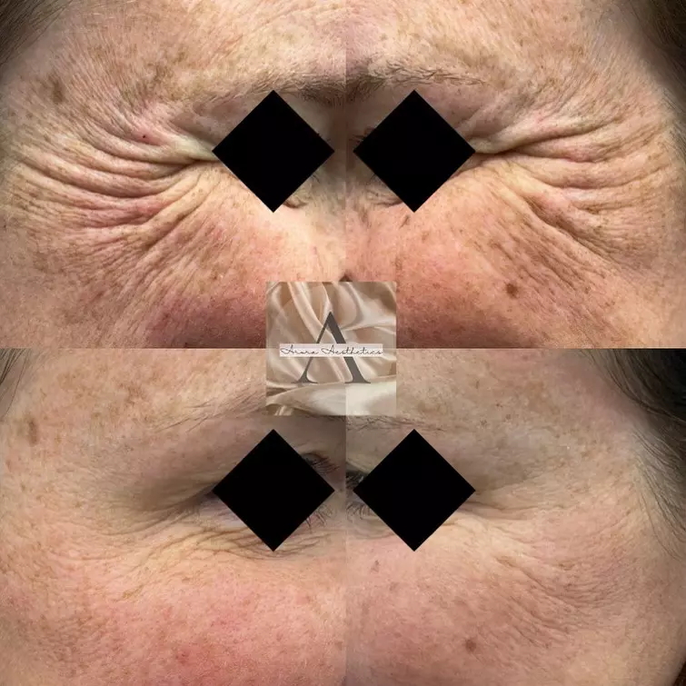 facial-aesthetics-neasden_1_