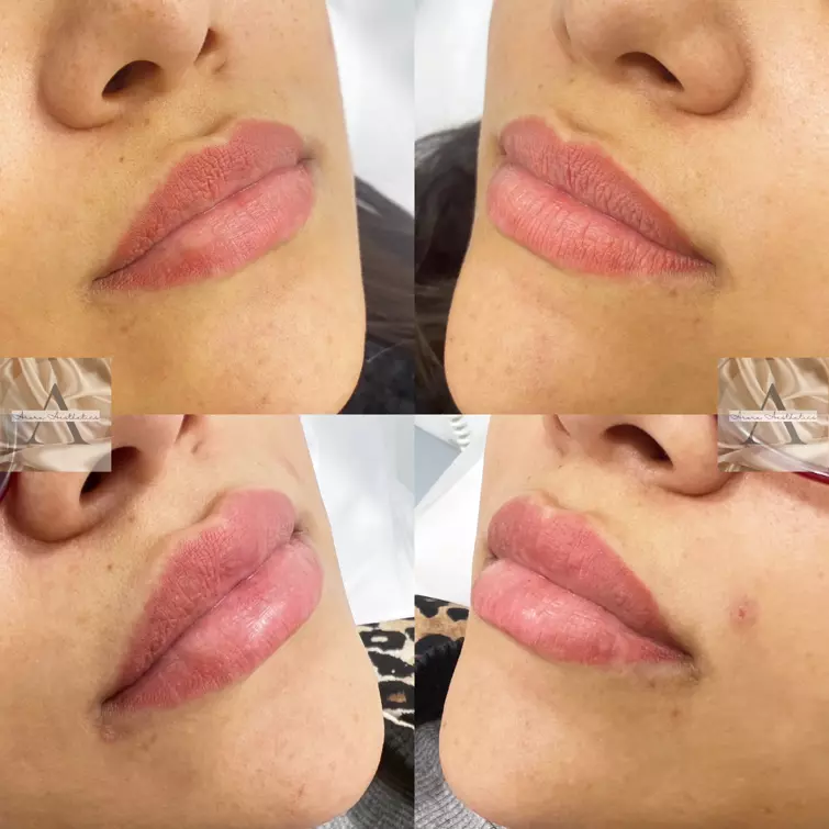 facial-aesthetics-neasden_2_